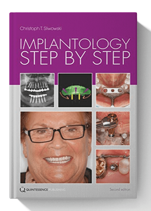 Implantology Step by Step 1st Edition