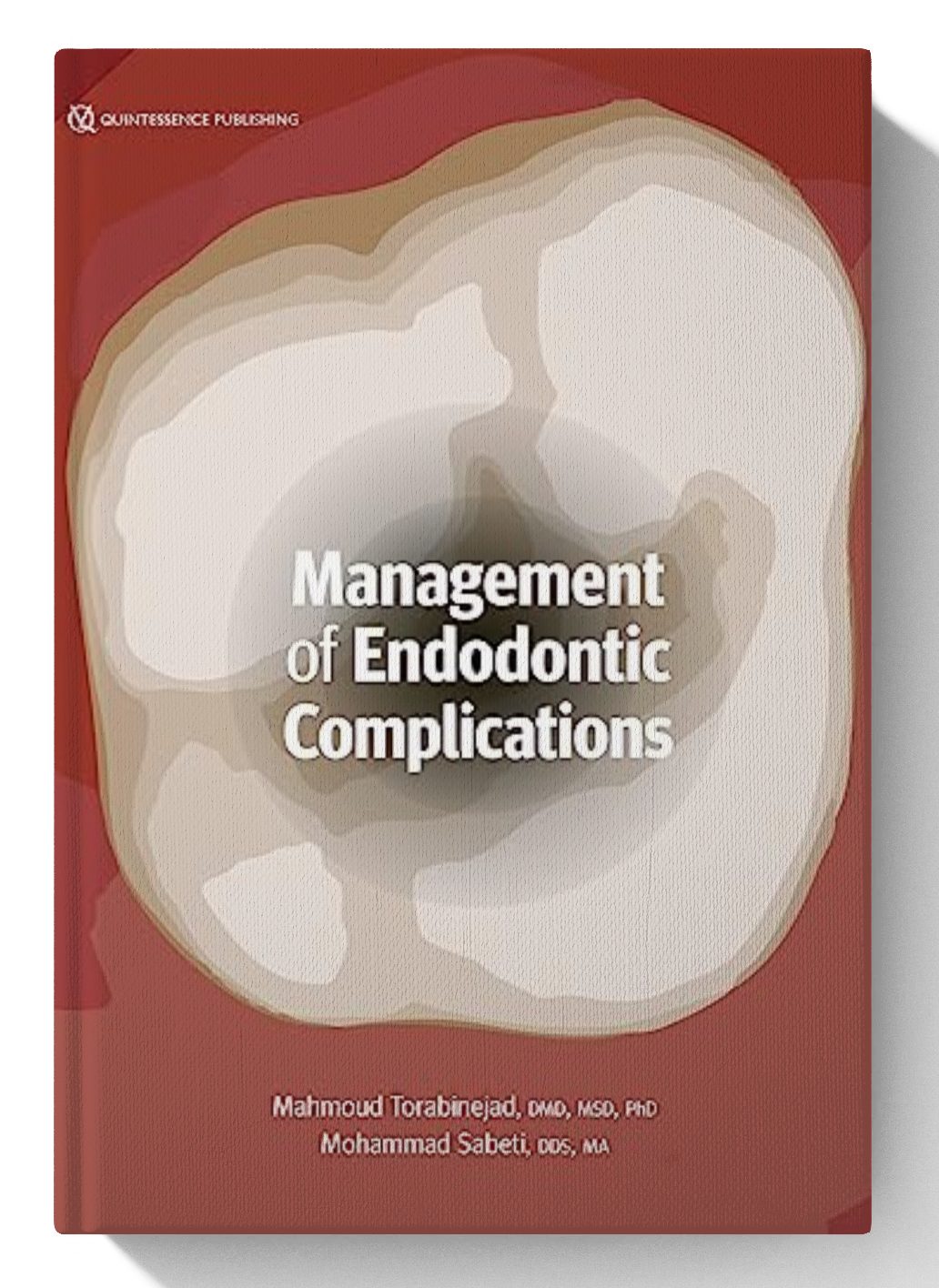 Management of Endodontic Complications: From Diagnosis to Prognosis