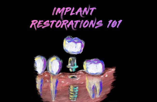 Implant-Restorations-101