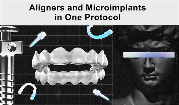 Aligners-and-Microimplants-in-One-Protocol (1)