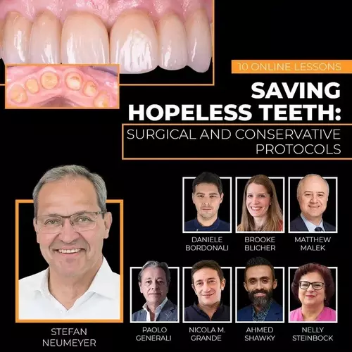 Saving-Hopeless-Teeth-Surgical-and-Conservative-Protocols (1)