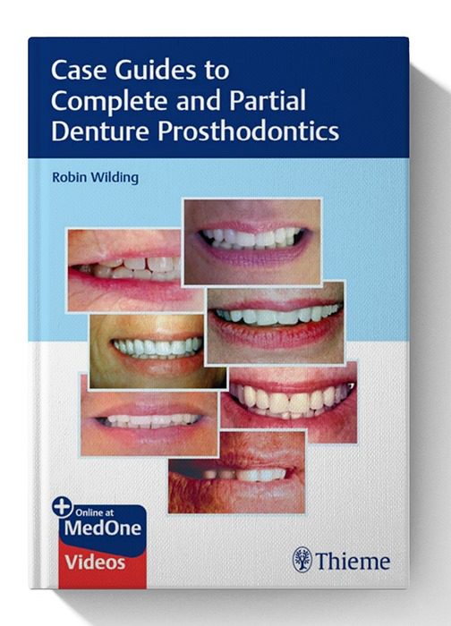 Case Guides to Complete and Partial Denture Prosthodontics Case Guides to Complete and Partial Denture Prosthodontics