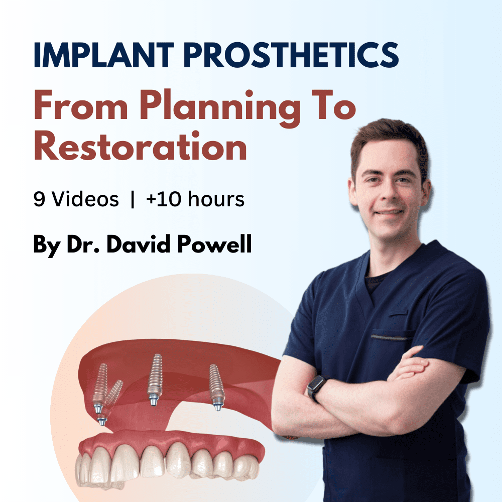 Implant Prosthetics: from Planning to Restoration