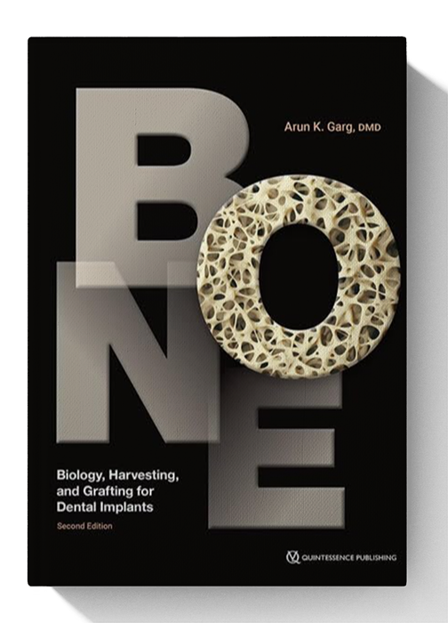 Bone: Biology, Harvesting, and Grafting for Dental Implants 2nd Edition
