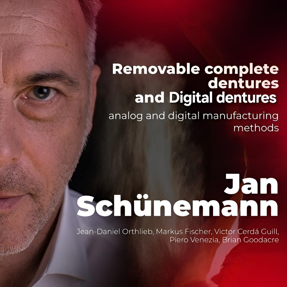 Removable Complete Dentures And Overdentures: Analog And Digital Manufacturing Methods